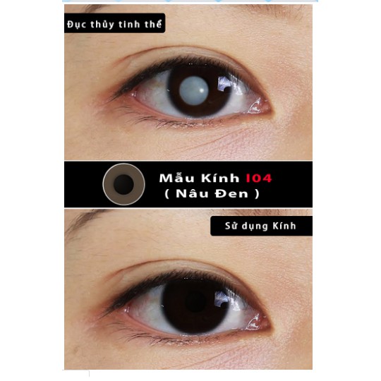 Kính áp tròng thẩm mỹ Qeye, lens che tật thị (che khuyết điểm) xuất xứ Hàn Quốc