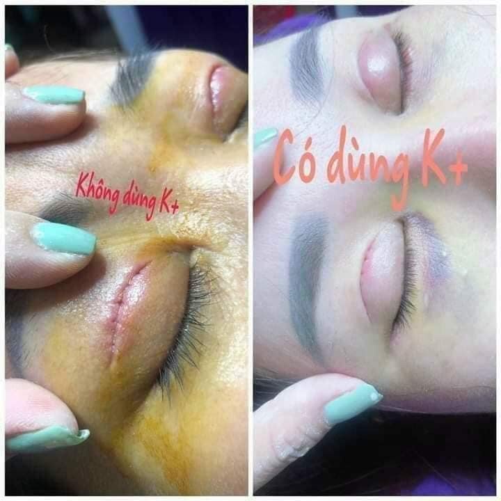 Serum siêu phục hồi da hư tổn trắng da, Xóa mờ các nếp nhăn, liền sẹo, làm đầy sẹo lõm  8ML - Super Reco Karmel