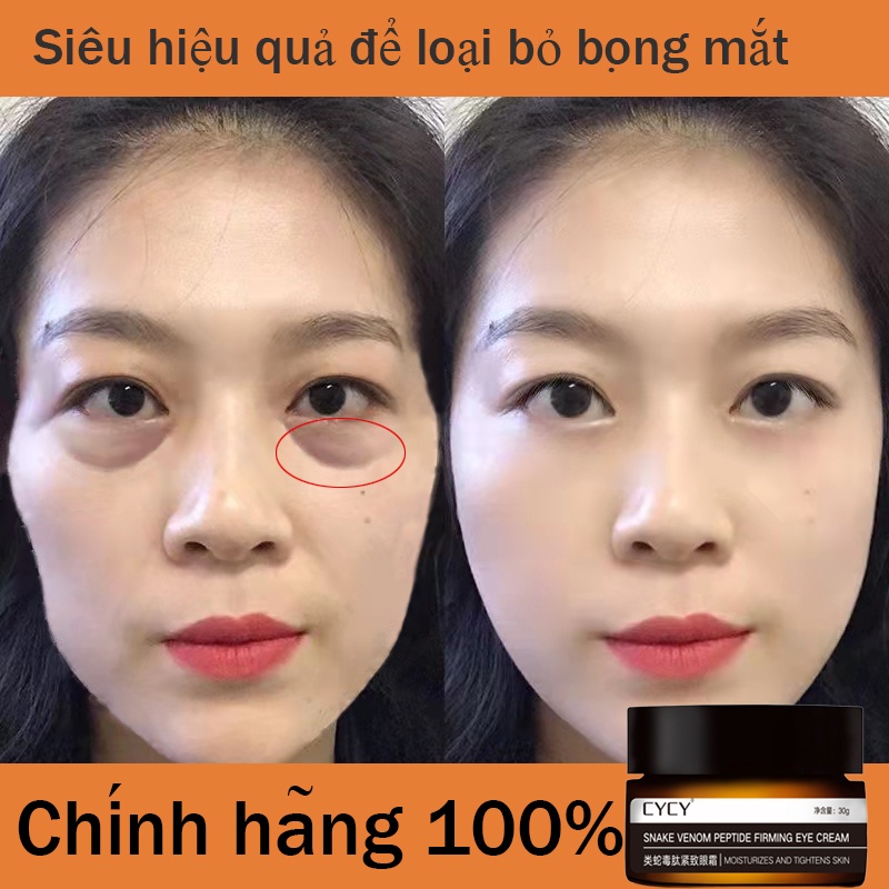 Kem Mắt Xóa Quầng Thâm Mắt 30g Kem Dưỡng Mắt Loại Bỏ Bọng Mắt Phục Hồi Làm Săn Chắc Và Cải Thiện Nếp Nhăn Quanh Mắt