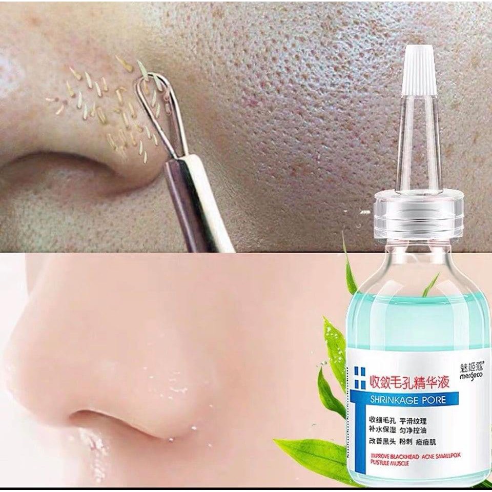 Serum che khít lỗ chân lông