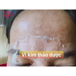 Vi Thảo Dược - Đông Y Tuệ Tĩnh