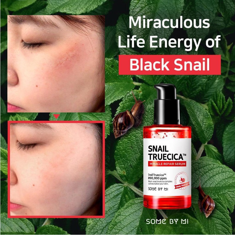 Tinh chất ốc sên đen phục hồi sẹo lõm và sẹo mụn Some By Mi Snail Truecica Miracle Repair Serum 50ml
