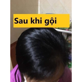 Dầu gội đen tóc Sâm Hàn Quốc dạng gói