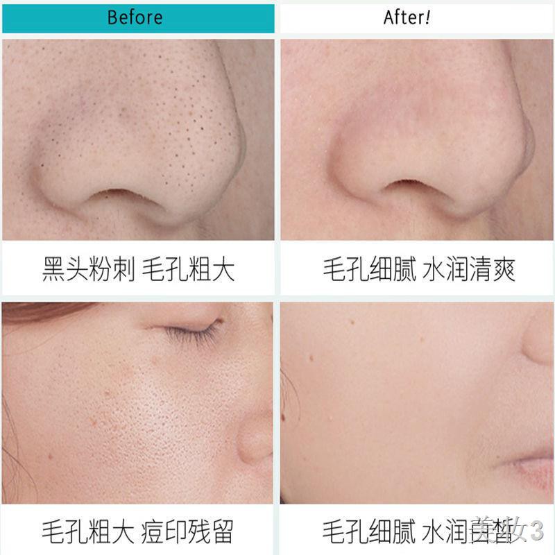 Cây Sumbody oxy hóa Milk White Mud Milch Moisturising Coll Lỗ chân lông Làm sạch mụn đầu đen trứng cá Mặt nạ đóng c