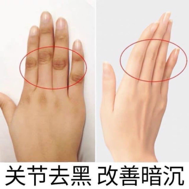 Kem che phủ thâm Pibamy ( đầu gối , khuỷu tay , nách , mắt cá chân...) | BigBuy360 - bigbuy360.vn