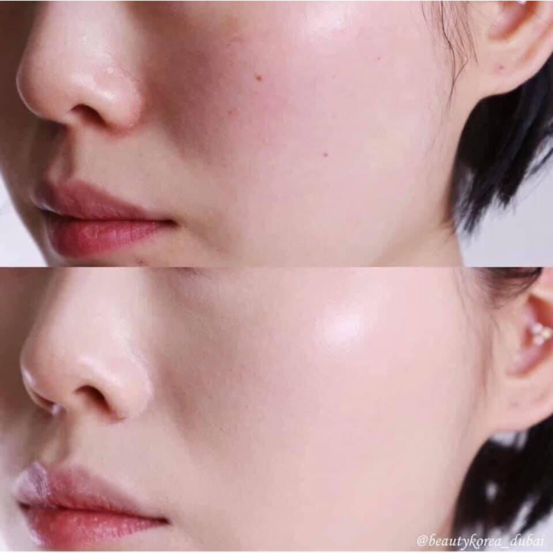 kem chống nắng SJM Medial Anti Uv Dr.Skincare