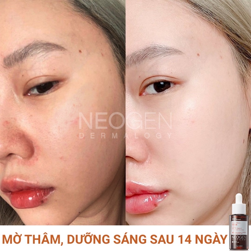 Tinh chất sáng da mờ thâm NEOGEN DERMALOGY REAL VITA C SERUM