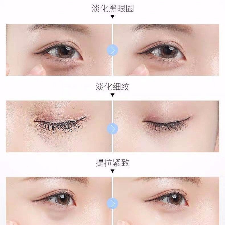【Beautifulying】  Electric massage eye cream to remove wrinkles and bags under the eyes fat particles dark circles artifact | BigBuy360 - bigbuy360.vn