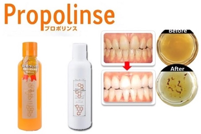 Nước súc miệng Propolinse