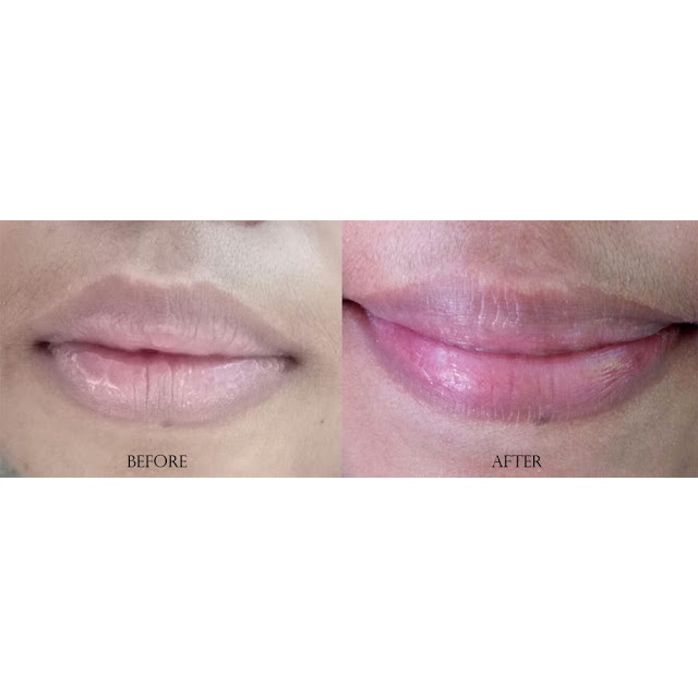 (Hàng Mới Về) Serum Dưỡng Môi Elsheskin 10 gr - Elshe | BigBuy360 - bigbuy360.vn