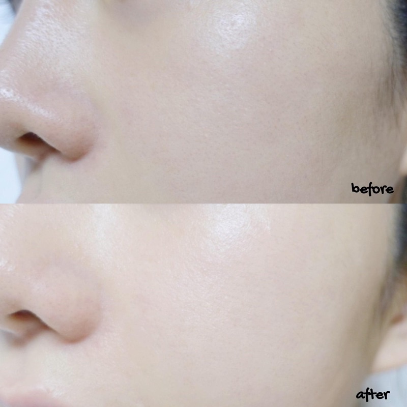 Nước thần, tẩy trang, cân bằng, dưỡng ẩm & tẩy da chết nhẹ cho da Beauty Water Son & Park | BigBuy360 - bigbuy360.vn