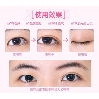 CUỘN KÍCH MÍ -