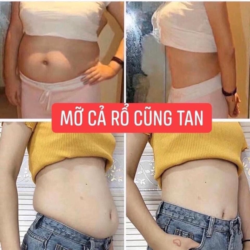 Kem Tan Mỡ Bụng Hot Body Slimming Hàn Quốc Tạm Biệt Mỡ Bụng Chân Voi Eo Bánh Mì Bắp Tay To