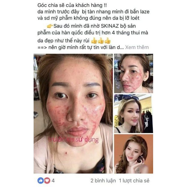 [HÀNG CHÍNH HÃNG] TINH CHẤT BƠ DƯỠNG DA KHỎE CĂNG BÓNG SÁNG HỒNG SKINAZ HÀN QUỐC0