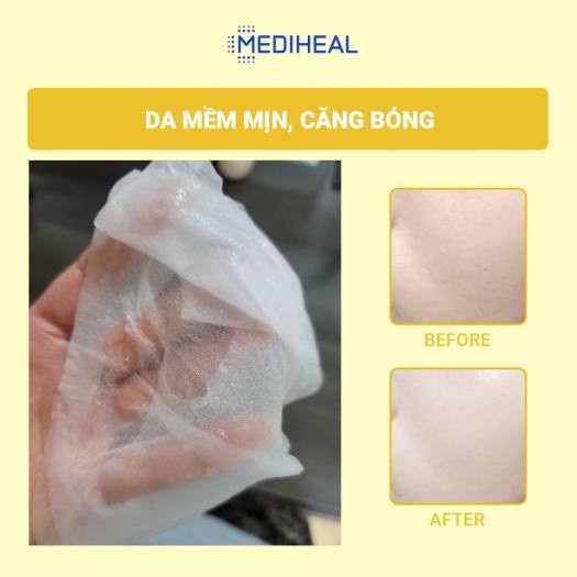 Mặt Nạ Dưỡng Trắng Da, Mờ Thâm Nám Mediheal Essence Mask 20ml - Vita Toning