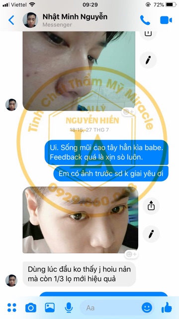 Tinh chất nâng mũi Pháp Miracle | BigBuy360 - bigbuy360.vn