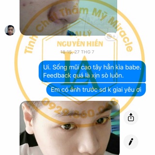 [ HÀNG CAO CẤP ] Tinh chất nâng mũi Pháp Miracle