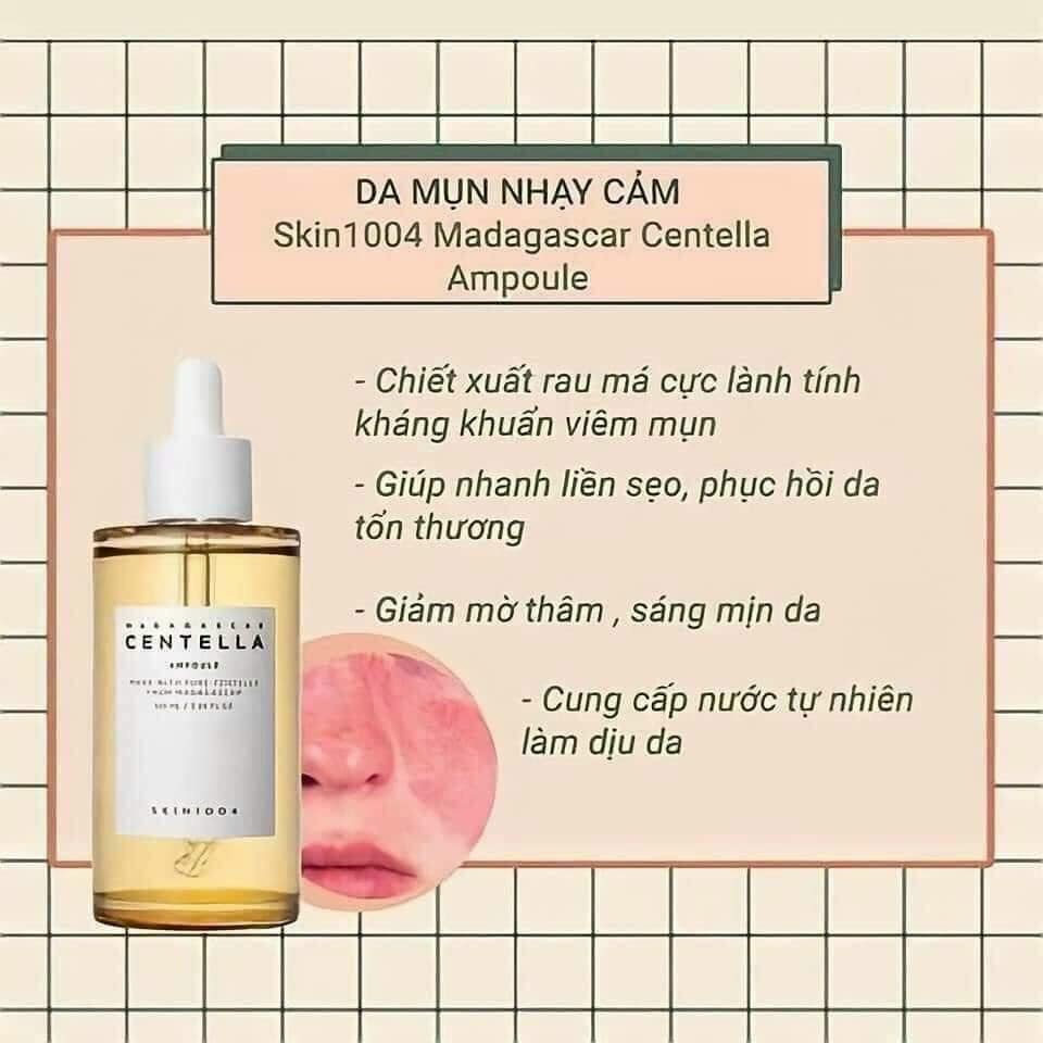 [ PHÂN PHỐI CHÍNH THỨC ] Tinh Chất Giảm Mụn, Viêm, Mờ Thâm, Làm Dịu Và Phục Hồi Da Skin1004 Madagascar Centella 55ml