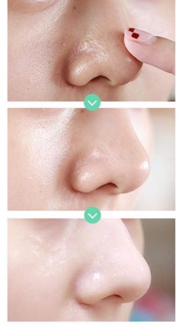 Serum Heyxi - tinh chất se khít lỗ chân lông hiệu quả | BigBuy360 - bigbuy360.vn