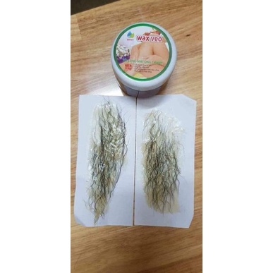 Was lông vĩnh viễn tận gồc triệt sạch lông chân ,lông tay ,lông nách, râu ria....