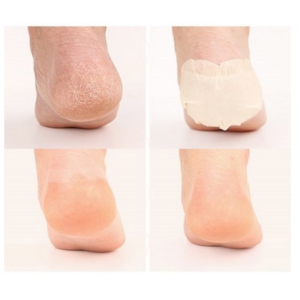 Set 10 miếng dán dưỡng ẩm bàn chân chứa AHA