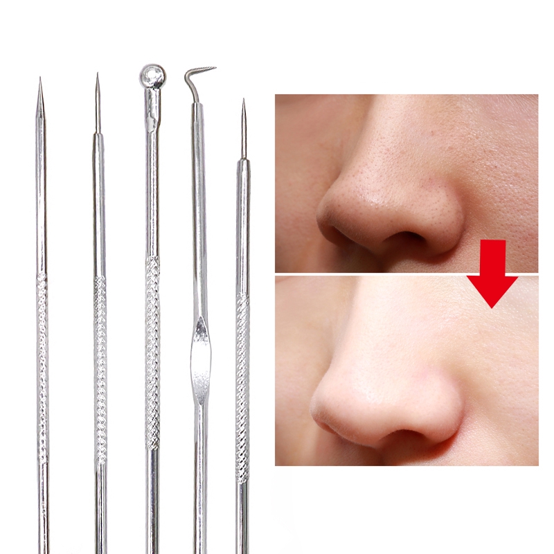 Dụng Cụ Nặn Mụn Đầu Đen Bằng Thép Không Gỉ