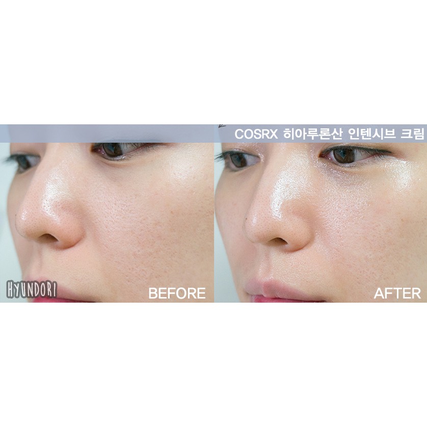 Kem Dưỡng Da Cấp Nước Chuyên Sâu COSRX Hyaluronic Acid Intensive Cream 100g