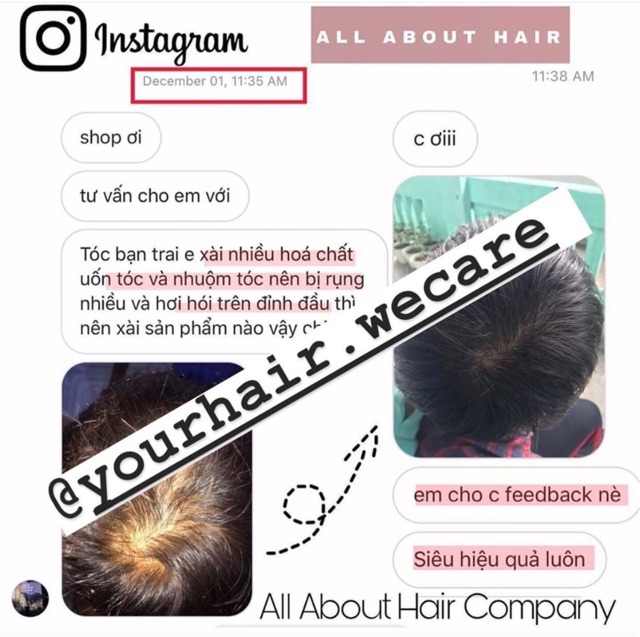 Dầu ủ OIL TREATMENT - |TẶNG Kem ủ + Mũ Trùm | | BigBuy360 - bigbuy360.vn