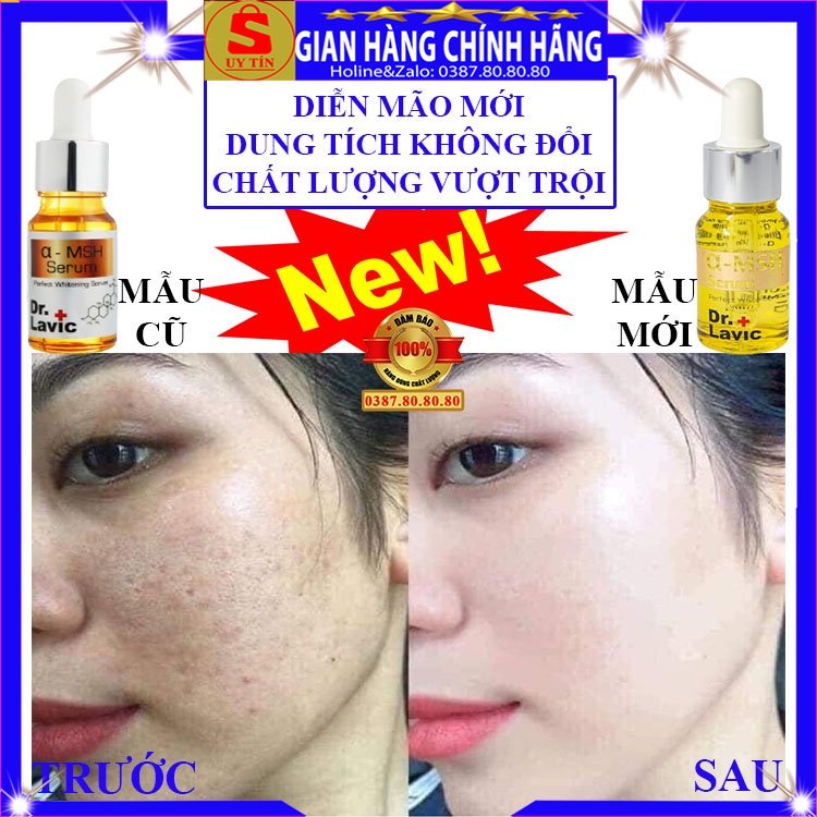 Tinh chất serum thâm nám tàn nhang đồi mồi dưỡng trắng da MSH Dr.lavic chính hãng lột nám chân sâu mảng bổ sung collagen