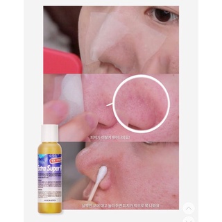 Ủ MỤN ĐẦU ĐEN MEDIPEEL