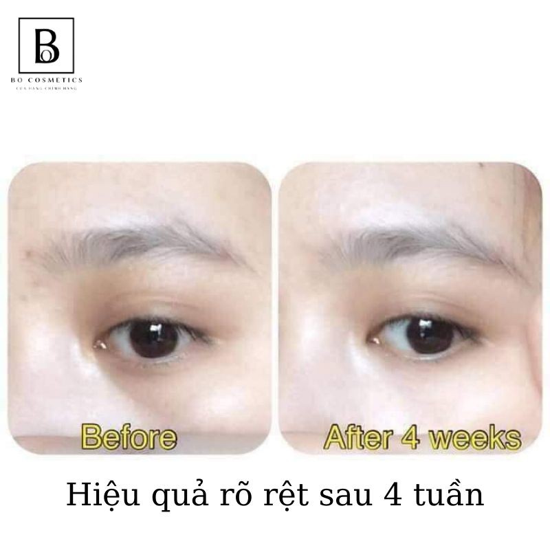 Kem Giảm Thâm Quầng Mắt KUMARGIC EYE Nội Địa Nhật Bản 20g  [AUTH]  [Chính Hãng] | BigBuy360 - bigbuy360.vn