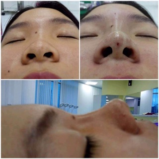 Chỉ Misko 26