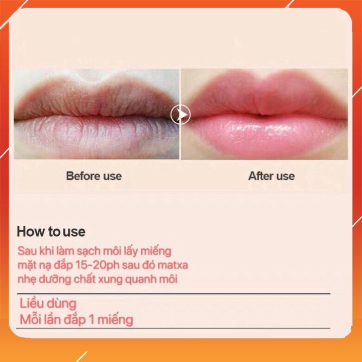 MẶT NẠ MÔI HOA HỒNG DƯỠNG ẨM MỀN MÔI CĂNG MỌNG [hộp 20 miếng]