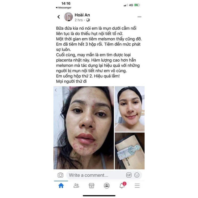 Nên uống melsmon nhau.thai.ngựa Nhật bản