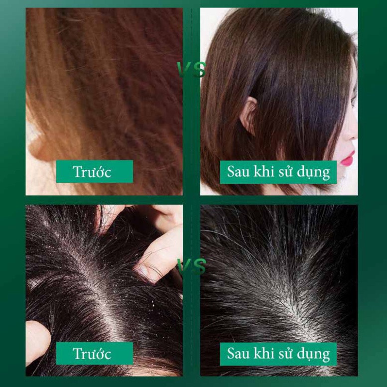 Tẩy da chết da đầu NORO kiểm soát dầu nhờn giảm bết tóc làm sạch chăm sóc tóc tại nhà NDGK1