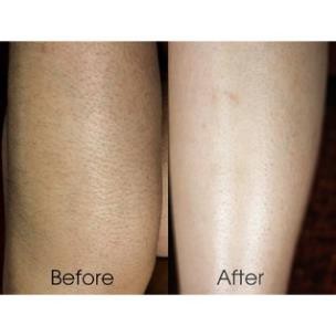 Kem tẩy lông velvet, Kem tẩy lông an toàn hiệu quả | BigBuy360 - bigbuy360.vn