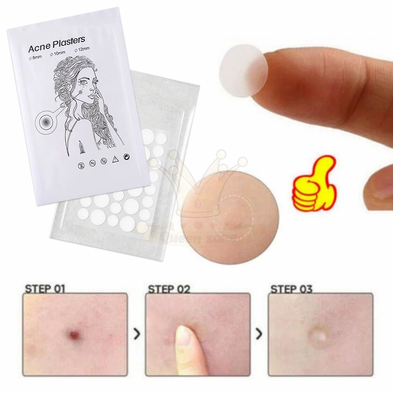 Set 36 Miếng Dán Hỗ Trợ Giảm Mụn Vô Hình Tiện Dụng Miếng Dán Hỗ Trợ Cải Thiện Mụn Kiểm Soát Dầu Không Thấm Nước