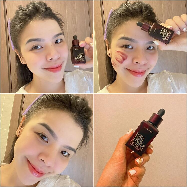 Red Peel Tingle Serum Premium 20ML Tinh Chất Tái Tạo Peel Da Sinh Học  So Natural Chính Hãng Hàn Quốc [Mẫu Mới 2020]