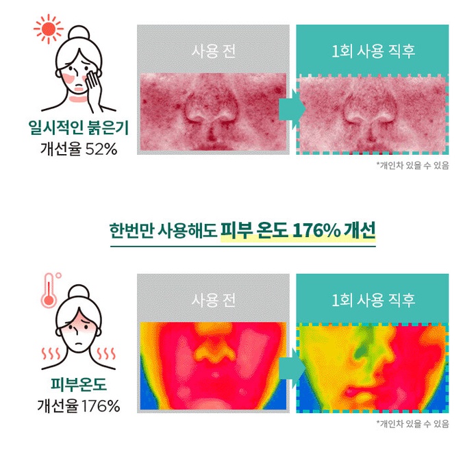 Set Serum A-cica 365 Làm Dịu Da 40ml + 40ml + Toner25ml