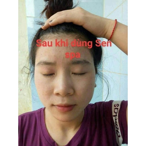 Combo Serum Thảo Dược + Bột Thảo Mộc Sen Spa Mẫu Mới