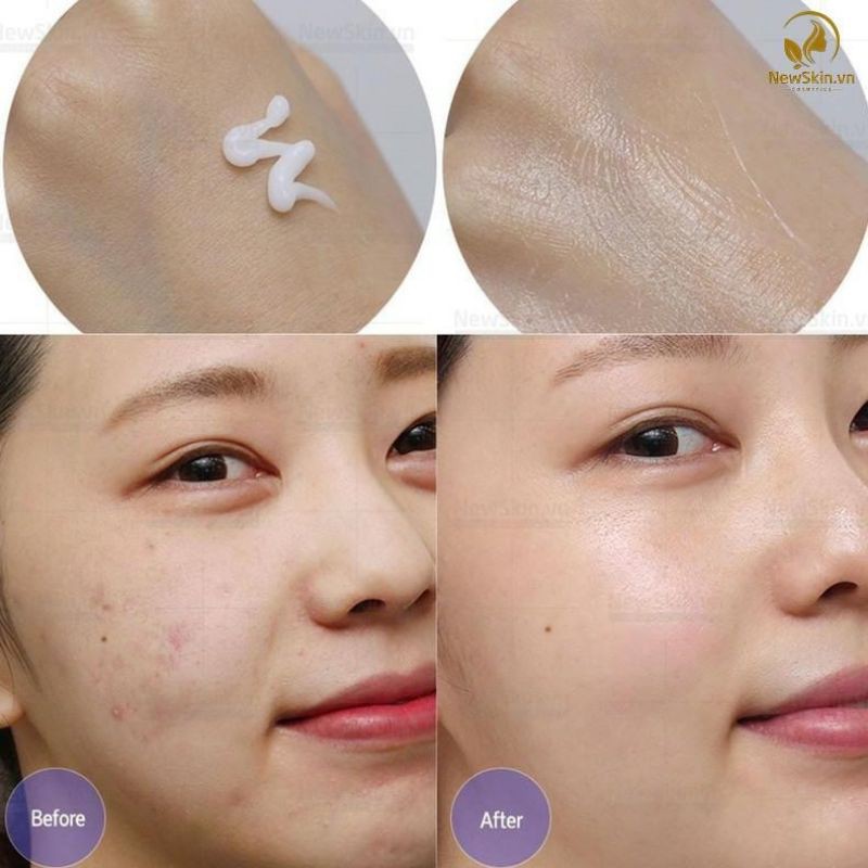 ✓ chính hãng✓ gel chấm mụn làm dịu kích ứng da innisfree Bija cica balm Ex 7ml