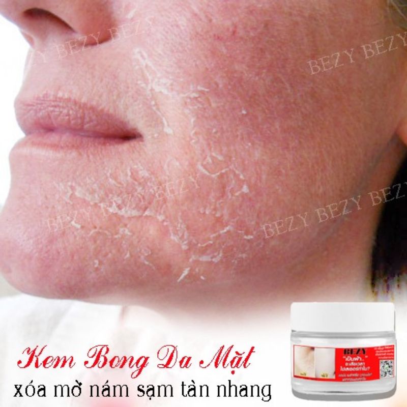 Kem Bong Da Mặt Trắng Da Mờ Thâm Nám