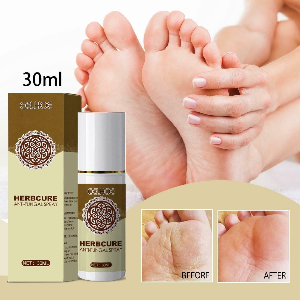 [Hàng mới về] Xịt dưỡng bàn chân thảo dược cải thiện tình trạng nấm chăm sóc làn da 30ml