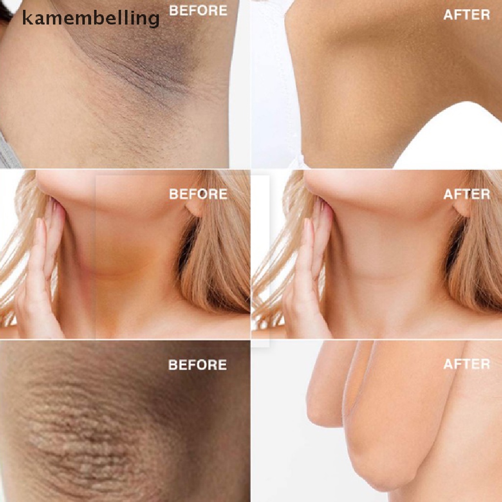 Xà Phòng Kojic Acid Làm Trắng Sáng Da Toàn Thân