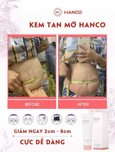 Kem Tan Mỡ Hanco _ Mua 1 tặng 1 giảm mỡ sau 20 phút đánh bằng dụng cụ quà tặng