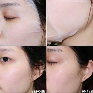 Lẻ Miếng Mặt Nạ Banobagi Hàn Quốc