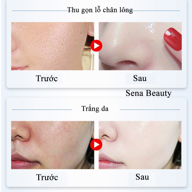 Serum Dưỡng Trắng Da Se Khít Lỗ Chân Lông Giảm Mụn Đầu Đen Shrinkage Pore Qianzi