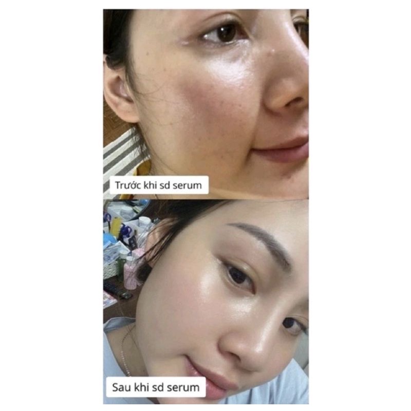 ⭐Serum mộc       tuyết date mới nhất⭐