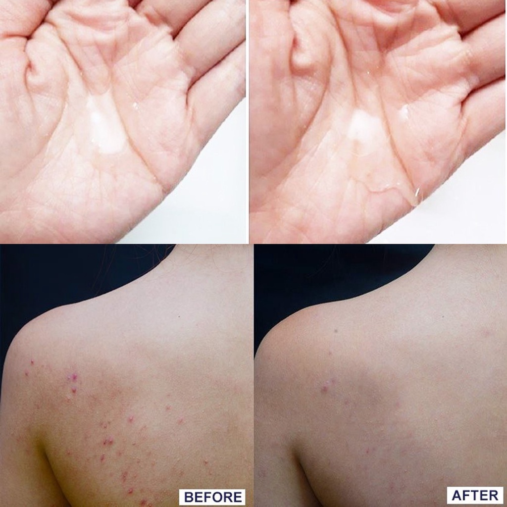 Gel Rửa Mặt Và Tắm Giảm Mụn La Roche-Posay Effaclar Micro-Peeling Purifying Gel 50ml - Xanh Lá