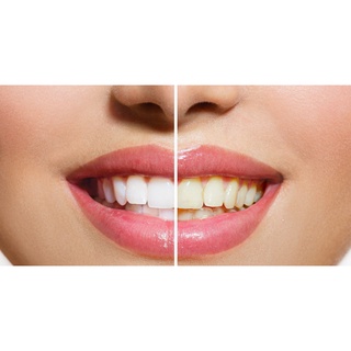 Combo 3 cây kem đánh răng Closeup (mỗi cây 30gr) Date mới 24 tháng